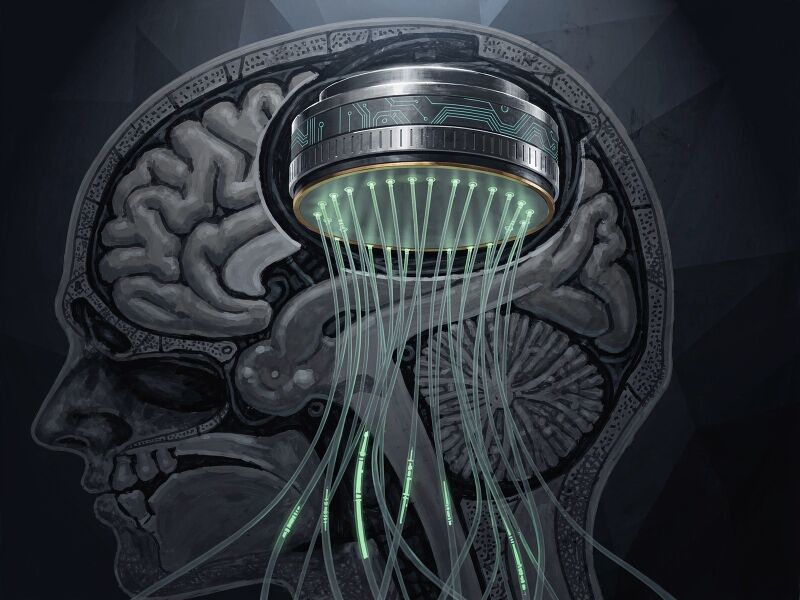 File:Neuralink-The-N1-chip-Link-implant-with-64-electro-4f4bbeef.jpg